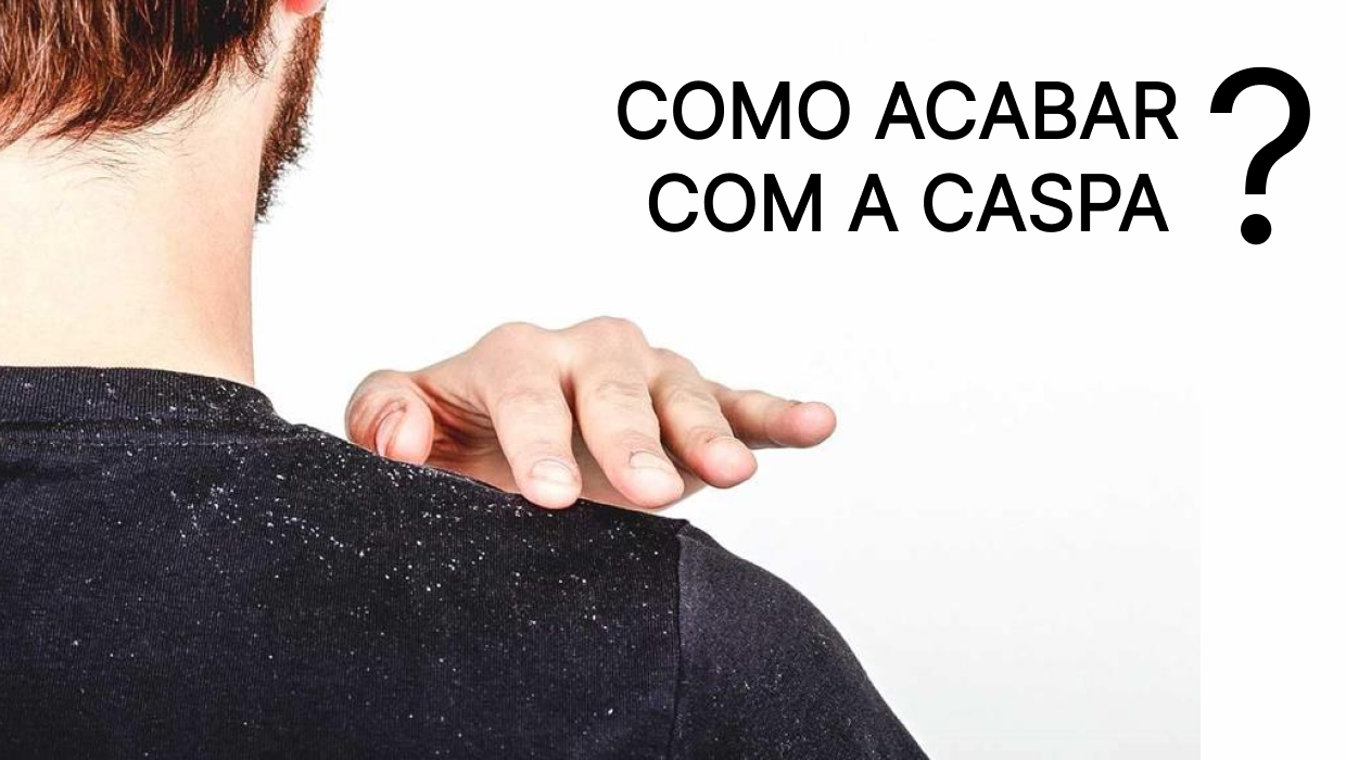 remédio caseiro para acabar com a caspa