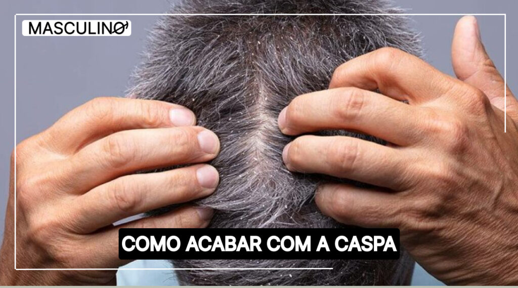 como acabar com a caspa