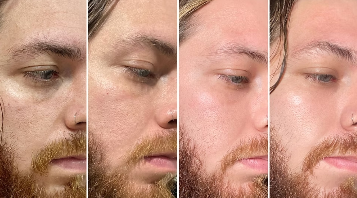 Skincare Masculino antes e depois